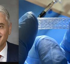 Well-known cardiologist Peter A. Soukas, MD, FACC, FSCAI, FSVM, FACP, has become chief medical officer of carotid stent maker InspireMD Inc. 