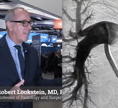 Video Robert Lookstein on mechanical thrombectomy beating anticoagulation alone in pulmonary embolism in the late-breaking STORM-PE trial at TCT 2025.