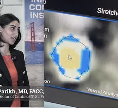 The Society of Cardiovascular Computed Tomography (SCCT) is seeing major progress in its long-running push to secure broad reimbursement for artificial intelligence (AI)-enabled coronary CT angiography (CCTA) plaque analysis. According to Roosha Parikh, MD, FACC, FSCCT, associate director of Cardiac CT at St. Francis Heart Hospital, Long Island, New York, and a member of the SCCT Health Policy and Practice Committee, both Medicare and a growing number of private insurers are now covering the technology.
