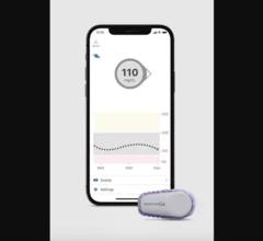 Dexcom is recalling a specific version of the Android smartphone app associated with its G6 Continuous Glucose Monitoring (CGM) System. 