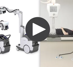 Canon Medical is launching new X-ray advances at the Radiological Society of North America (RSNA) 2025 annual meeting. This includes the advanced artificial intelligence Clear-IQ technology to boost diagnostic image quality of low-dose images, and the new Adora DRFi low-dose fluoroscopy system. Canon will also highlight the patented technology built into its premium mobile X-ray solution, the SOLTUS 500.