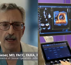 American Society of Echocardiography (ASE) President David H. Wiener, MD, FACC, FAHA, FASE, director of clinical operations at the Jefferson Heart Institute, and a clinical professor of medicine at Thomas Jefferson University, explains the growing number of multimodality cardiac imaging experts and how imaging societies need to change to meet their needs.