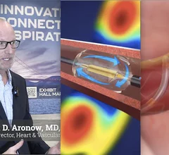 Herbert D. Aronow, MD, MPH, FACC, FSCAI, FSVM, medical director, heart and vascular service line and the Benson Ford Chair in Cardiology at Henry Ford Health, member of board, Society for Cardiovascular Angiography and Interventions (SCAI), the explains how hospitals can set up renal denervation (RDN) programs and how the reimbursement landscape is changing with new Medicare coverage.