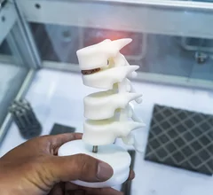 In-house radiology 3D printing could produce significant savings.