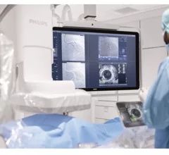 Philips agrees to acquire vascular imaging specialists SpectraWAVE