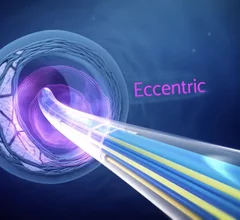 The Boston Scientific Seismiq intravascular lithotripsy (IVL) system entered commercial use in the U.S. in January 2026.