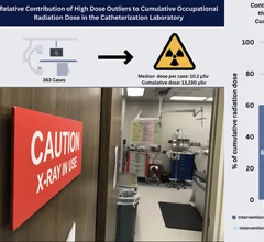 Ryan Madder, MD, Program Director, Interventional Cardiology Fellowship, William Beaumont University Hospital, Corewell Health East, and Michael Abiragi, MD, cardiology fellow, Frederik Meijer Heart and Vascular Institute, Corewell Health West in Grand Rapids, explain a study showing a small number of high dose cases contribute the majority of staff dose, especially STEMI.