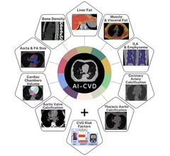 The U.S. Food and Drug Administration (FDA) has cleared HeartLung Corporation's AI-CVD, an artificial intelligence (AI) algorithm that looks at 11 different opportunistic health screening assessments on chest CT exams ordered for any reason.