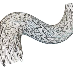 CGuard Prime carotid stent system was cleared by the U.S. Food and Drug Administration (FDA) in June 2025.