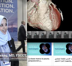 Mirvat Alasnag, MD, FACP, FACC, FSCAI, FSCCT, director of catheterization laboratory and research, King Fahd Armed Forces Hospital, Jeddah-Saudi Arabia, Ditrector of TCT Middle East, and member of Society of Cardiovascular CT (SCCT) Education Committee, explains how the society it translating its educational content into other languages to help a wider international audience of clinicians. SCCT is working to expand its international membership and this is a big part of that strategy.