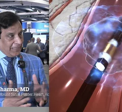 Advances in calcified coronary plaque modification are increasingly centered on intravascular lithotripsy (IVL) because the technology reduces complications such as vessel trauma and perforation associated with traditional high-pressure balloons or atherectomy techniques. Cardiovascular Business spoke with Samin K. Sharma, MD, director of the Mount Sinai Fuster Heart Hospital Cardiovascular Clinical Institute, recently about the advances in IVL. #IVL #TCT