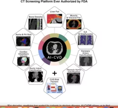 FDA clears HeartLung's opportunistic AI-CVD platform