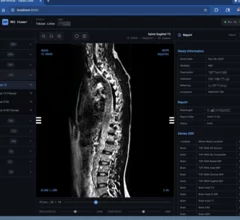 Shopify CEO says he created his own MRI viewer with AI