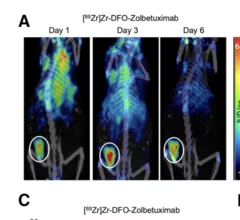 Novel theranostic shows promise for treating gastric and pancreatic cancer