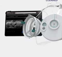 iSono Health announces commercial launch of portable, wearable breast ultrasound device