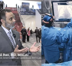 Sunil Rao, MD, director, interventional cardiology, cardiac catheterization laboratory, NYU Langone Heart, professor, Department of Medicine, the Leon H. Charney Division of Cardiology, NYU Grossman School of Medicine, discusses the heart team approach in the context to determining what is best for the patient in terms of bypass surgery or percutaneous coronary intervention.
