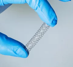 iron bioresorbable scaffold Biotyx Medical 