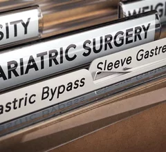 weight loss surgery bariatric Roux-en-Y gastric bypass and sleeve gastrectomy