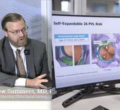 Matthew Summers, MD, FACC, program director for structural heart, Sentara Heart Hospital, Norfolk, Virginia, explains how his center used a new transcatheter aortic valve replacement (TAVR) 3D CT planning software to better identify patients who are at high risk of complications. The software also enables the heart team to test the best placement of various valves to create a procedure plan tailored for each patients unique anatomy.