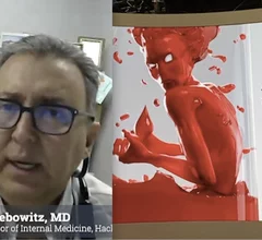 Nathaniel Lebowitz, MD, in charge of preventive cardiology at Hackensack University Medical Center, and assistant professor of internal medicine at Hackensack Meridian School of Medicine, gives an overview of where things are at with lipoprotein (a) awareness, testing and drug development. He and is working on the American Heart Associations (AHA) Lp(a) Discovery Project to expand awareness to both physicians and patients. #AHA #LPA