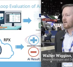 Walter Wiggins, MD, PhD, a neuroradiologist and director of clinical AI at Mosaic, explains how large language model (LLM) artificial intelligence is increasingly being used in radiology to extract structured data from narrative radiology reports to improve workflow, and to help validate, monitor and improve other AI tools being used in clinical practice.