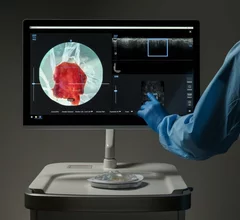 claire perimeter medical imaging 