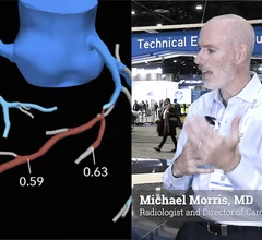 Radiologist Michael Morris, MD, radiologist and director of cardiac CT and MRI at Banner Health, explains how cardiac radiology imaging is moving toward expanded use of fractional flow reserve CT (FFR-CT) and artificial intelligence analysis of coronary CT angiography (CCTA) exams as a standard of care. He spoke to Radiology Business during RSNA 2025.