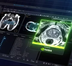 Nvidia Philips MRI