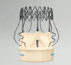 corcym Perceval Plus LANCELOT