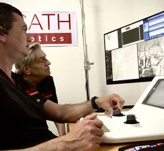 XCath Robotics, a Houston-based medical robotics company, announced the successful completion of the world’s first telerobotic stroke operation of its kind. Neurosurgeon Vitor Mendes Pereira, MD, chair of advanced neurovascular interventions at the University of Toronto, used the XCath Iris Surgical Robotic System to perform the historic procedure.