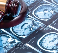 court brain scan legal gavel lawsuit malpractice judge