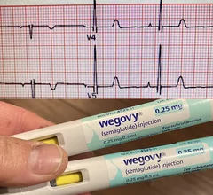 GLP-1 receptor agonists (GLP-1-RAs) have become the wonder drug not only of weight loss, but also for improving cardiovascular health in a growing number of positive cardiovascular trials. The latest study of more than 13,000 patients presented at Heart Rhythm 2026 this week showed the GLP-1 reduce atrial fibrillation (AFib) and survival, even after accounting for the drug’s impact on weight loss. 