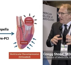 Gregg Stone, MD, FACC, FSCAI, Professor of Medicine (Cardiology) at the Icahn School of Medicine at Mount Sinai Hospital in New York, presented the results of the long-awaited STEMI Door or Unloading time trial, which takes a different approach to first using a percutaneous heart pump to unload the heart 30 minutes prior to PCI interventions to try and prevent common complications and improve outcomes. 