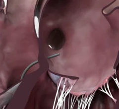 Protaryx Transseptal Puncture Device