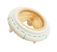 Mosaic Neo mitral valve from Medtronic