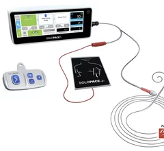 The SoloPace Fusion Temporary Pacing System from Solo Pace Inc. is deigned to eliminate the need for right ventricular (RV) lead placement, which requires the added procedural step to gaining venous access. This can cut procedure time and mitigate possible complication risks. For interventional cardiologists using improvised left ventricular (LV) pacing, this system can replace ad-hoc clip assemblies, subcutaneous needles and exposed wire connections, which are known sources of inconsistent pace capture. 