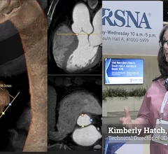 Kimberly Hatch, RT(R)(CT)(ARRT), technical director of 3D lab at Banner Health, explains the advances in advanced visualization software what is needed to build a comprehensive cardiac 3D imaging lab. 