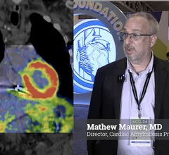 Video of Mathew S. Maurer, MD, director, Cardiac Amyloidosis Program, NewYork Presbyterian Hospital, explains how the American Hearty Association’s ATTR Amyloidosis Initiative is bringing together multidisciplinary teams to strengthen management of transthyretin amyloid cardiomyopathy (ATTR-CM). The goal is to catch more of these patients earlier and ensure they get timely care before they end up in advanced heart failure. #ATTR #Cardiacamyloidosis