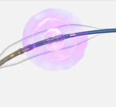 Boston Scientific’s Seismiq 4CE Coronary IVL Catheter