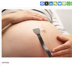 Wearable ultrasound patch continuously monitors pregnancies