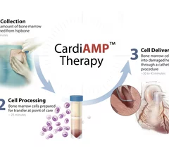 BioCardia's CardioAMP heart failure cell therapy.