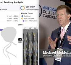 Cardiologist Michael McMullan explains his surprise about high levels of soft coronary plaque seen on CCTA despite years of intensive statin therapy. #YesCCT
