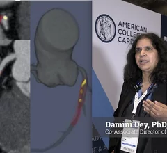 Damini Dey, PhD, FSCCT, a professor of biomedical sciences, co-associate director of the Biomedical Imaging Research Institute, and director of the quantitative image analysis program at Cedars-Sinai, explains how artificial intelligence (AI) is impacting cardiovascular imaging without most people realizing.