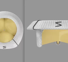 The Edwards Lifesciences Triformis Resilia surgical tricuspid valve top and side views..