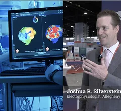 Joshua R. Silverstein, MD, FHRS, a cardiac electrophysiologist at Allegheny Health Network Cardiovascular Institute, explains the real-world impacts of Centers of Medicare and Medicaid Services (CMS) RVU cuts in electrophysiology.