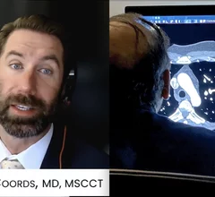 Michael Coords, MD, FSCCT, Medical Director of Cardiovascular Imaging, RadNet, a leader with the SCCT Health Policy and Practice Committee Regulatory Task Force, and incoming co-chair of the Health Policy and Practice Committee, says SCCT offers a unique blend of clinical education, business strategy, and networking to stay on top of CCTA's rapid proliferation.