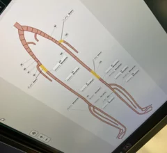 pad peripheral femoral and illiac artery diagram for cvis interventional reporting for fujifilm hims23