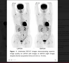 Whole-body PET system reduces image acquisition time.
