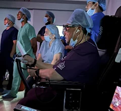 Sudhir Srivastava performing a left internal mammary artery (LIMA) takedown robot-assisted heart procedure on a patient in India, with the surgeon located at Georgetown Public Hospital Corp. (GPHC) in Guyana, 12,500 miles away.