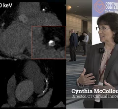 ynthia McCollough, PhD, FAAPM, FACR, FAIMBE, professor of medical physics and biomedical engineering, and director of the CT Clinical Innovation Center and X-ray imaging core at Mayo Clinic, Rochester, has been working on conventional CT and photon-counting CT research for years. She shares and overview of the advantages of photon-counting CT scanners as compared to conventional EID (energy-integrating detector) technology. 